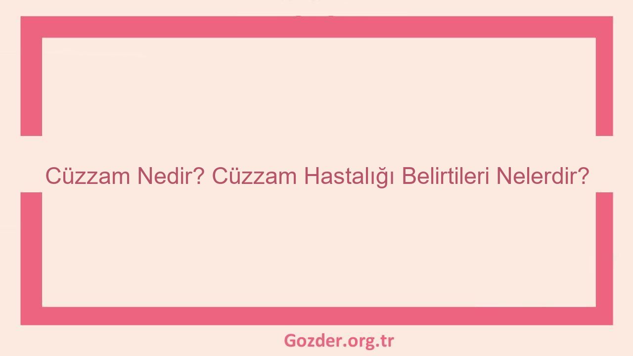 Cüzzam Nedir? Cüzzam Hastalığı Belirtileri Nelerdir? - Görseli